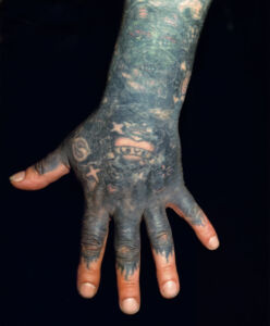Kalervo (hand) 5 000 € / Marked skin, 1999-2000, 110 x 86 cm, c-print black wooden frames + glass, signed, ed. 1/10